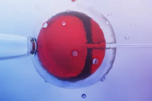 In Vitro Fertilization (IVF)