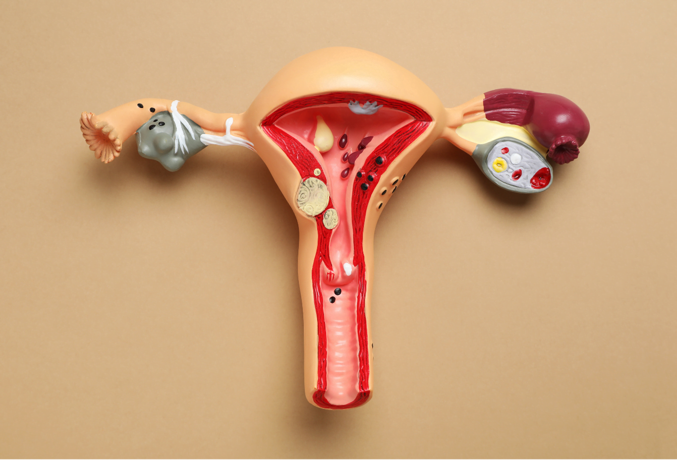 treatment of Blocked Fallopian Tubes at Best IVF Centre in Srinagar