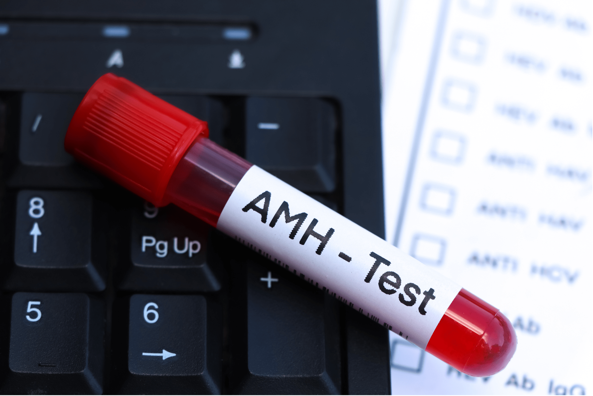 AMH Levels