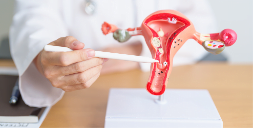 Natural Ways to Improve Uterine Health